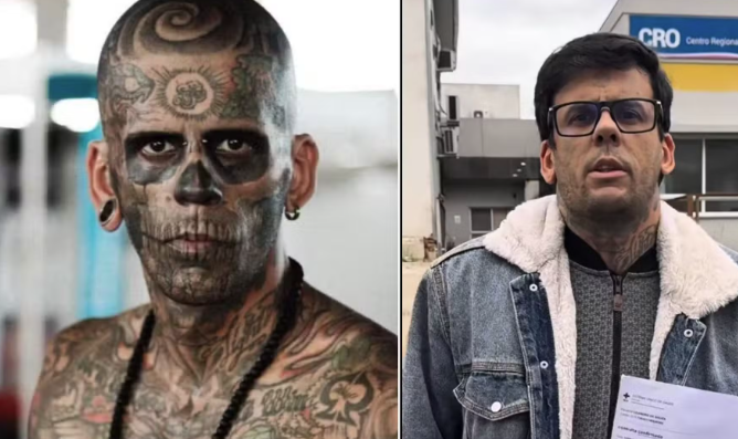 Homem mais tatuado do Brasil fará cirurgia na bexiga